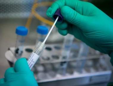 COVID-19: Unidades de saúde do Arroio Guaçu e Três Irmãs vão ser fechadas